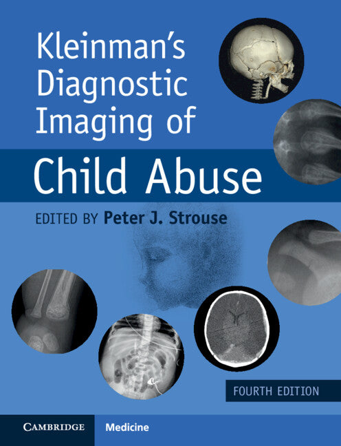 Kleinman's Diagnostic Imaging of Child Abuse (Revised)