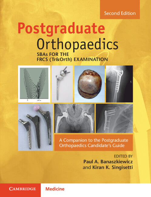 Sbas for the Frcs (Tr&orth) Examination: A Companion to the Postgraduate Orthopaedics Candidate's Guide (Revised)
