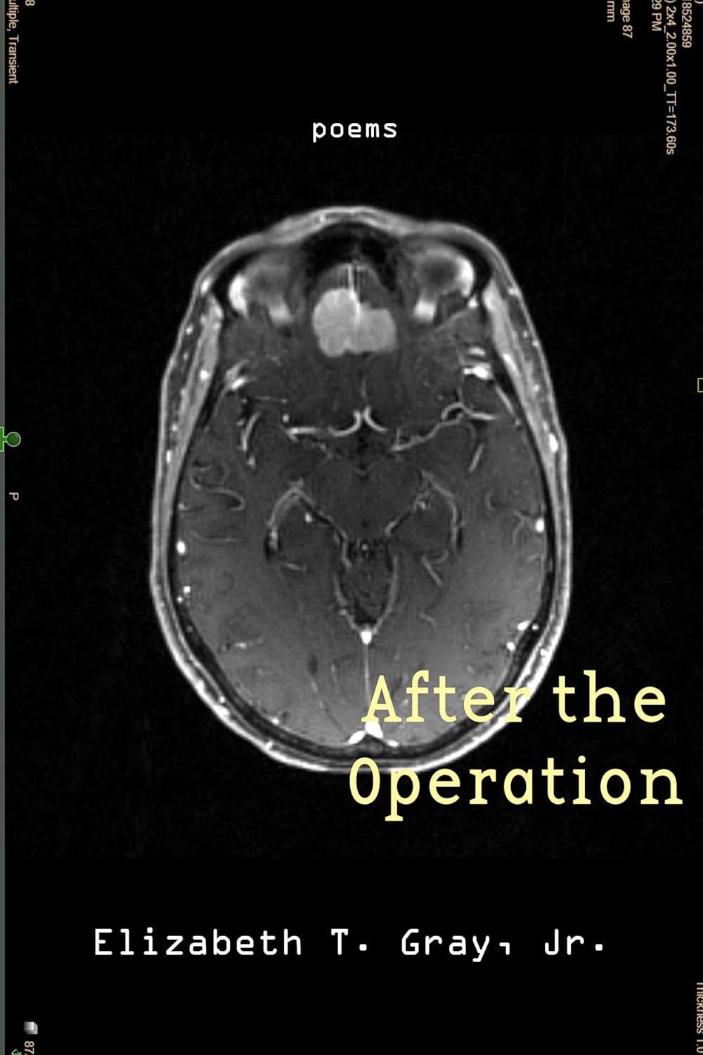 After the Operation