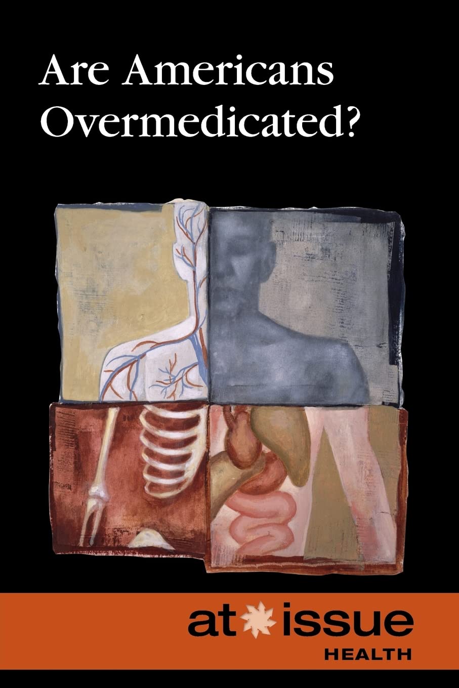 Are Americans Overmedicated?