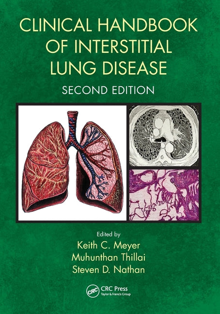 Clinical Handbook of Interstitial Lung Disease