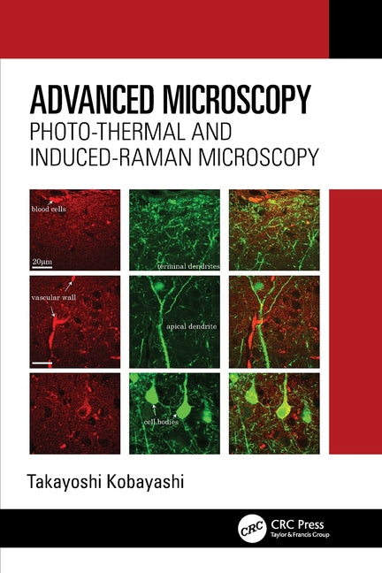 Advanced Microscopy: Photo-Thermal and Induced-Raman Microscopy