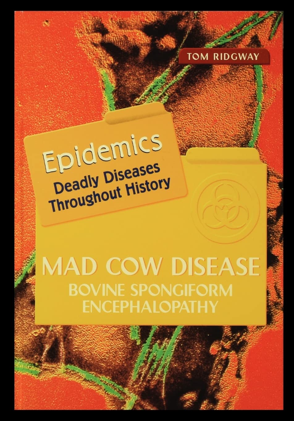 Mad Cow Disease: Bovine Spongiform Encephalopathy