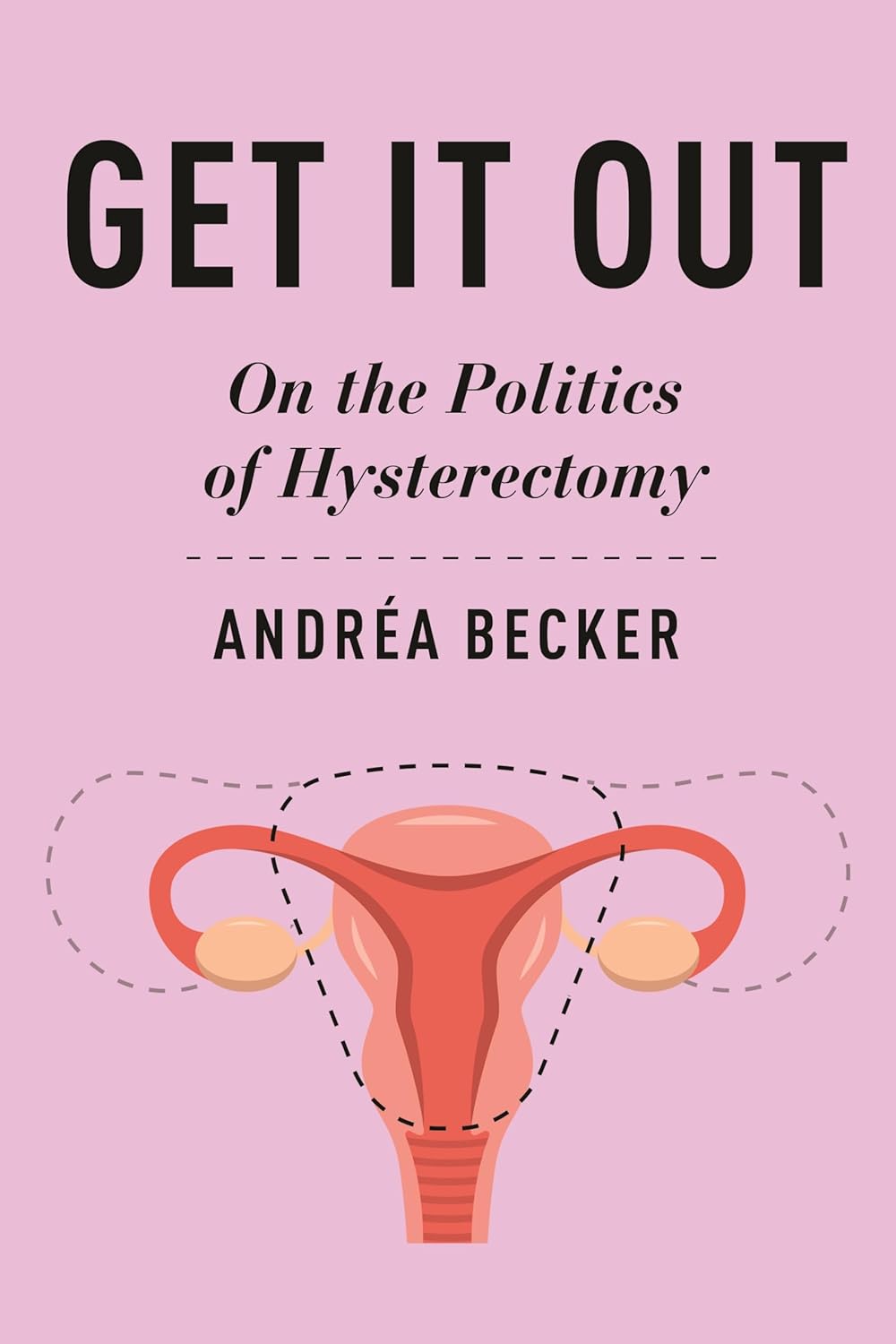 Get It Out: On the Politics of Hysterectomy