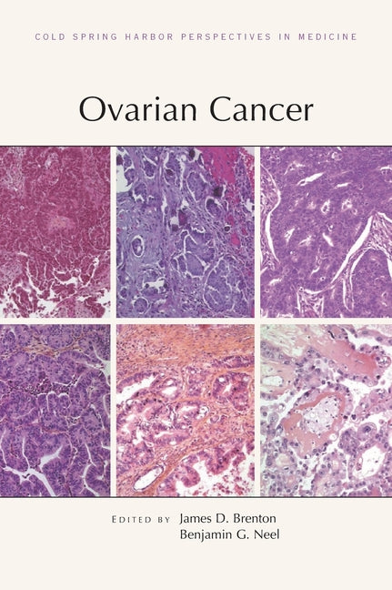 Ovarian Cancer