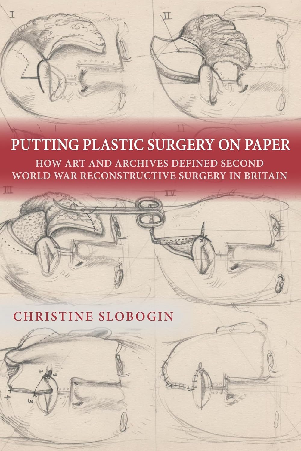 Putting Plastic Surgery on Paper How Art and Archives Defined Second World War Reconstructive Surgery in Britain