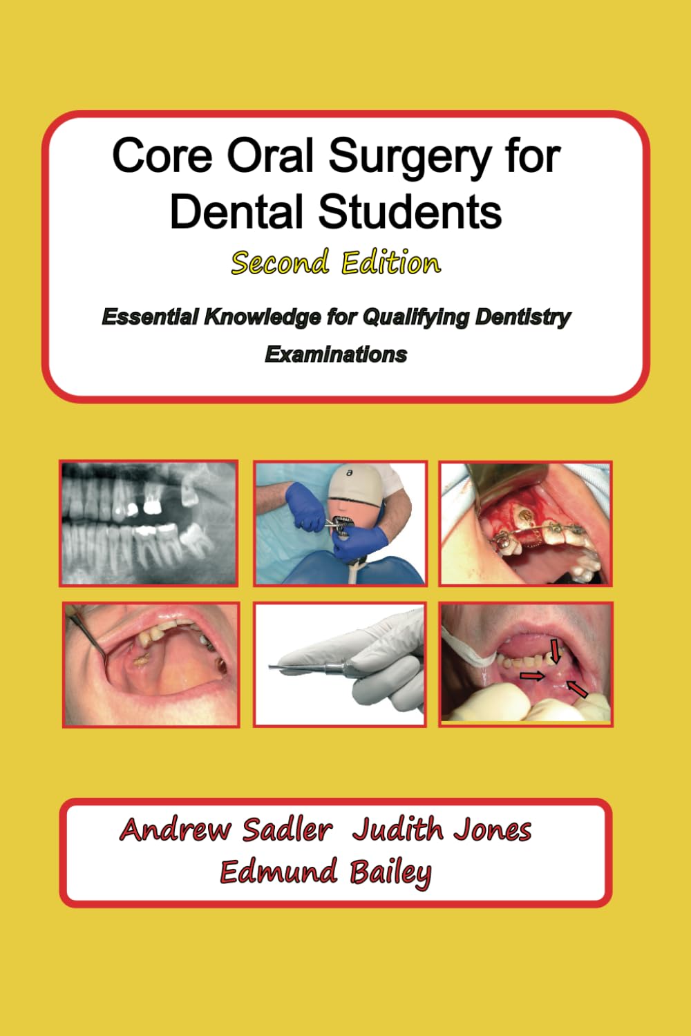 Core Oral Surgery for Dental Students Second Edition: Essential Knowledge for Qualifying Dentistry Examinations